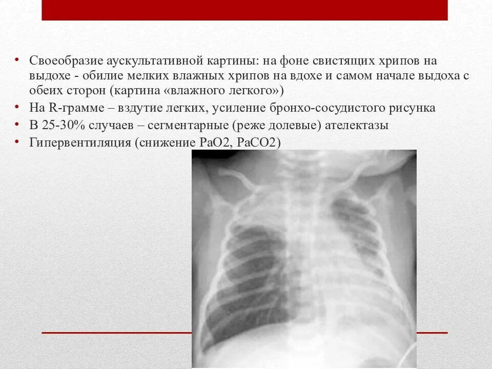 Свист в бронхах при выдохе причины. Хрипы при глубоком вдохе. хрипы при выдохе. звуки в легких. бронхит хрипы на выдохе.