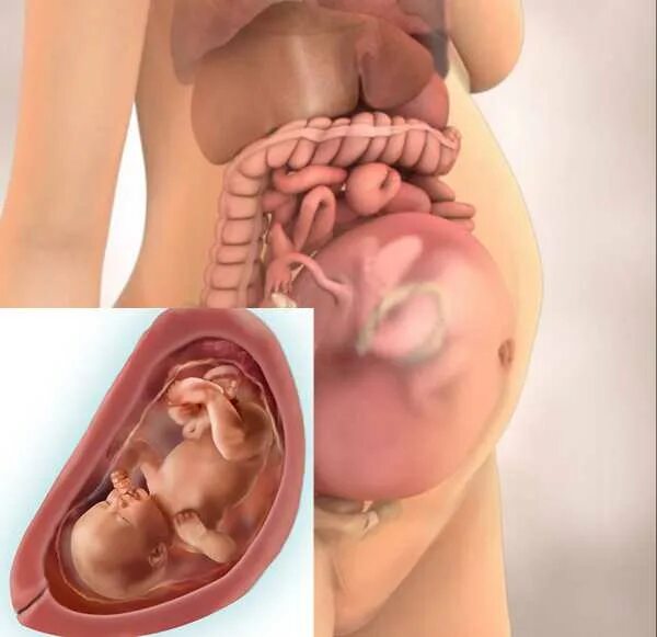 Плод на 34 неделе беременности. Расположение плода на 34 неделе беременности. Ребёнок в 34 недели беременности в животе. Расположение ребенка на 34 неделе беременности. 34 недель что происходит с малышом
