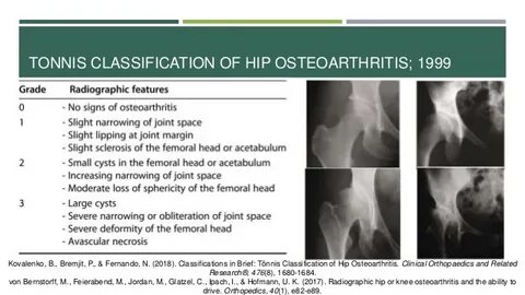 Polyarthritis латынь