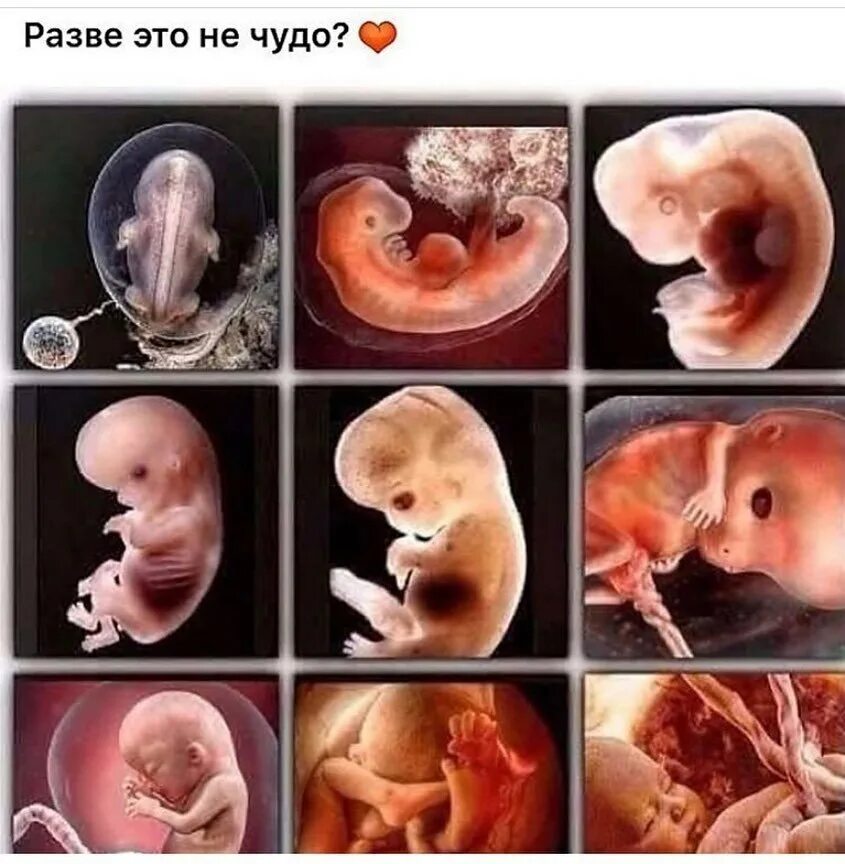 войта. таблица развития ребенка по месяцам до года мальчик. развитиеребенка по месчцам. эмбрион по неделям беременности фото. как выглядит эмбрион человека по месяцам.