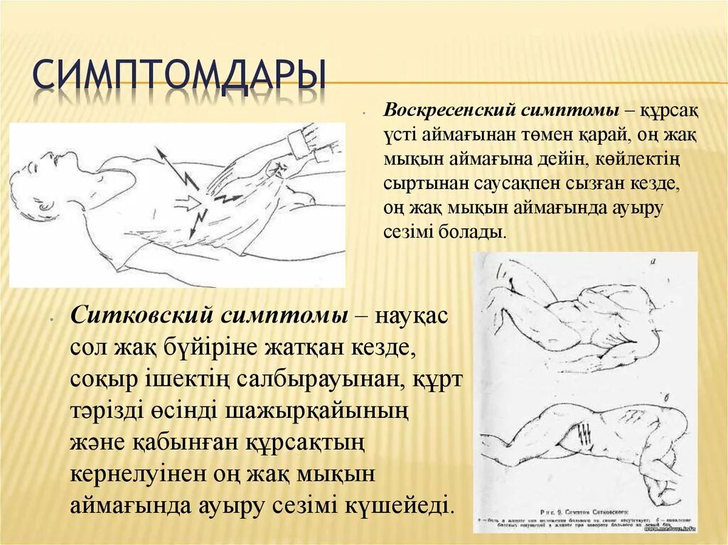 Щеткина—Блюмберга, Ситковского, Ровзинга, Воскресенского, Образцова. Симптом Воскресенского. Симптом Воскресенского симптом рубашки. Симптом Ровзинга и Ситковского.