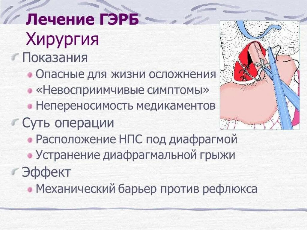 Гастроэзофагеальная рефлюкс-болезнь. Гастроэзофагеальной рефлюксной болезни. Гастроэзофагеальная рефлюксная болезнь симптомы. Симптомы гастроэзофагеальной рефлюксной болезни. Лечение гастроэзофагеального рефлюкса у взрослых