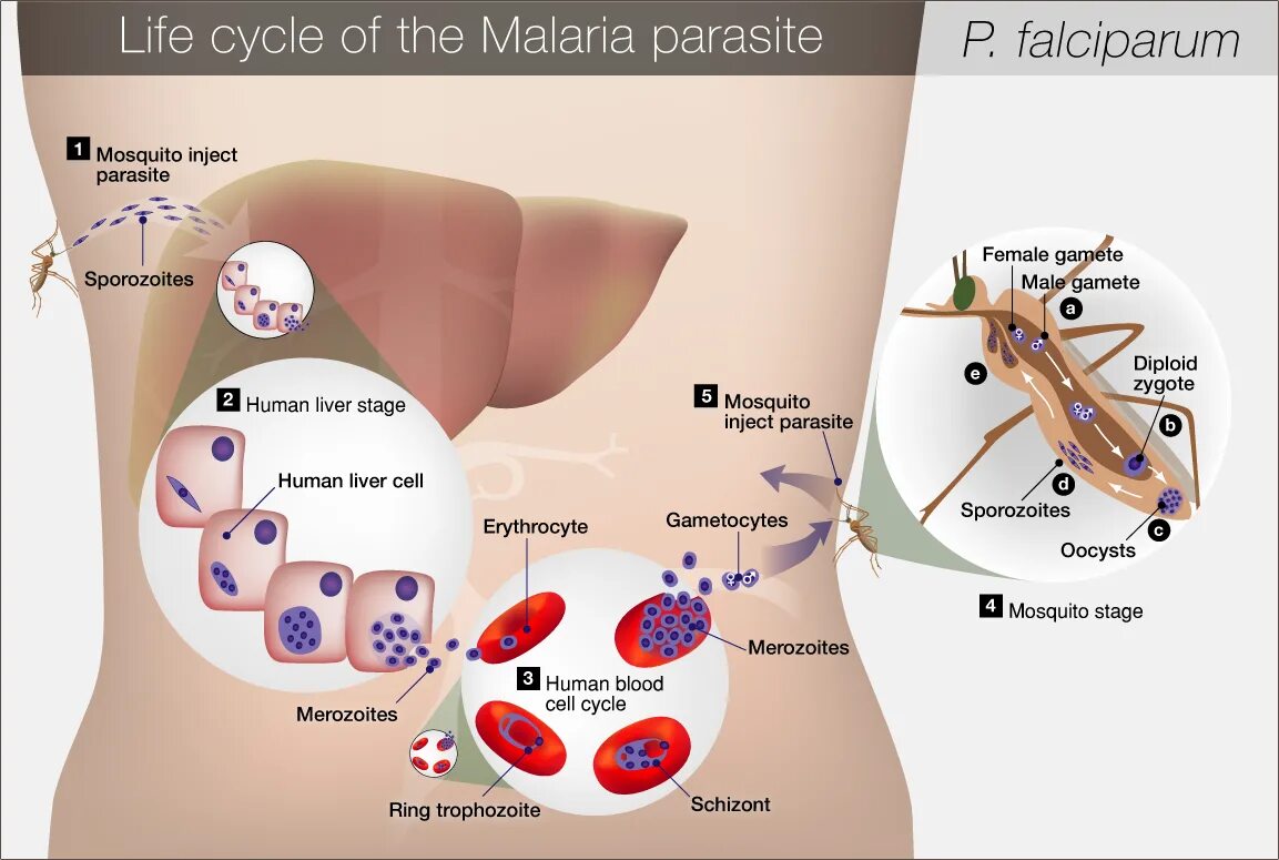 Переносчик Plasmodium falciparum. Иммунитет при малярии. Формы малярии.