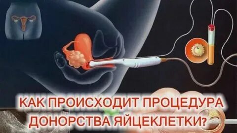 Донорство яйцеклеток ребенка