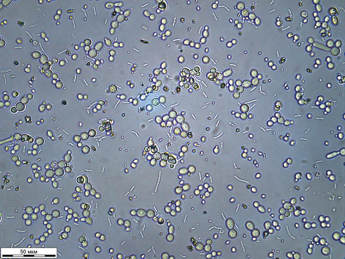 Бактерии в слюне. Дрожжей Saccharomyces cerevisiae микроскопия. Дрожжи Saccharomyces микроскопия. Saccharomyces cerevisiae микроскоп. Клетку дрожжей Saccharomyces cerevisiae.