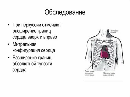 Почему сердце левее