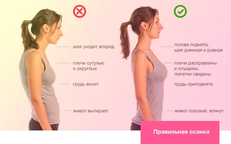 Как перестать горбиться