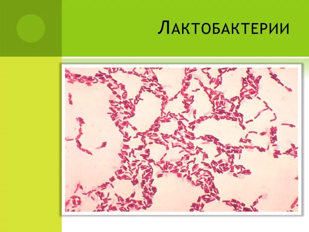 Лактобактерии какой тип питания. Строение лактобактерии. строение лактобактерий. лактобактерии структура. лактобактерия строение.