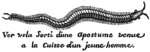 Des vers