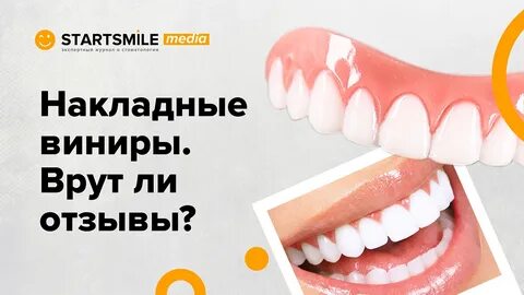 Startsmile