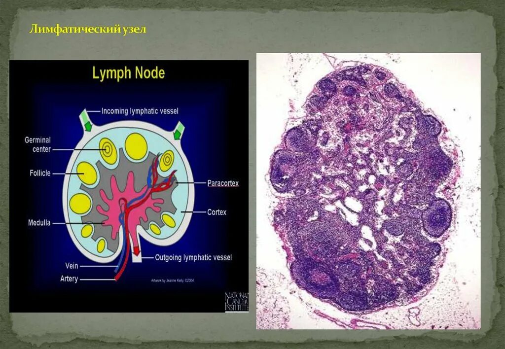 Корень лимфатического узла. Лимфатические узлы. Строение лимфатического узла. Строение лимфатического узла анатомия. Лимфоидные узелки.