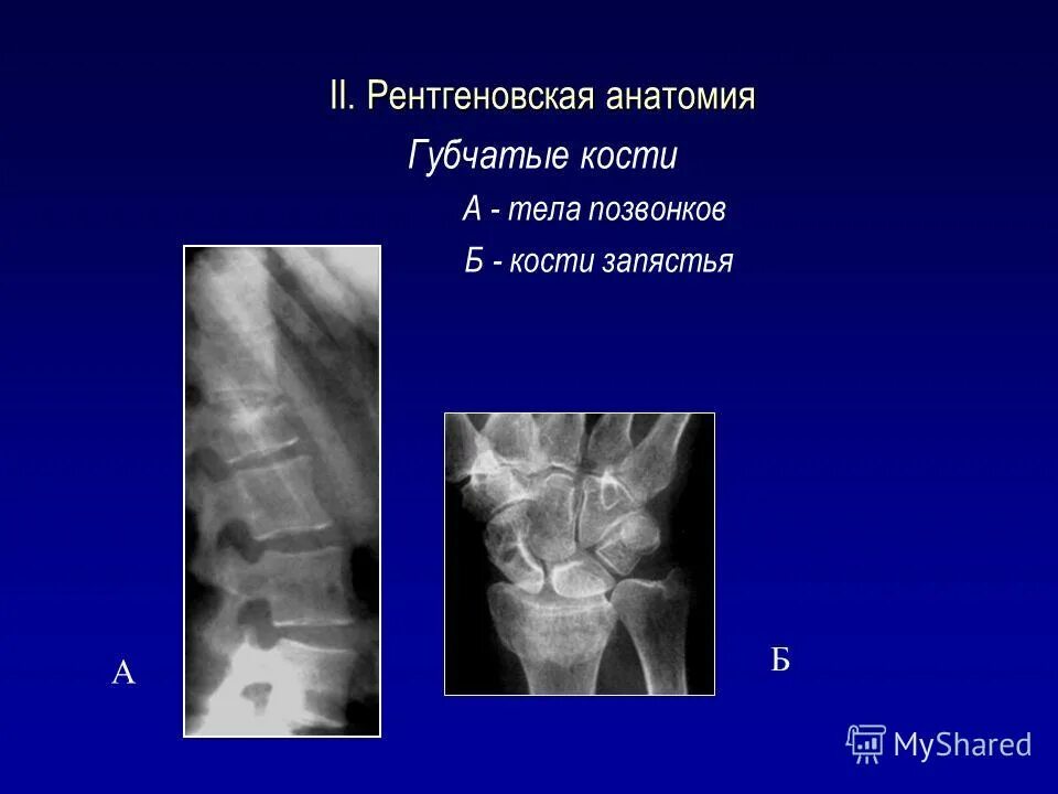 Рентген трубчатых костей. Рентген анатомия кости. Рентген анатомия кости. Локтевой сустав рентген описание. Лучевое исследование костно-суставной системы.