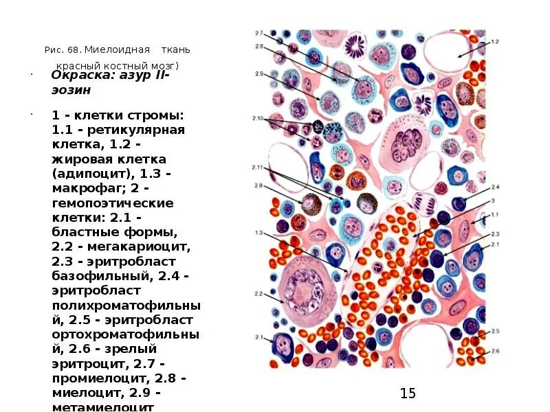 Гистология стромы что это. Гистологический препарат красный костный мозг. красный костный мозг препарат гистология. миелоидная ткань красного костного мозга. срез красного костного мозга препарат.
