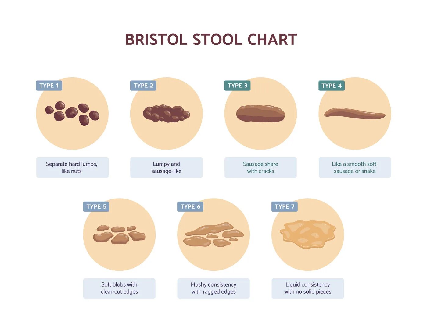 Классификация кала. Бристольская классификация формы кала. Типы кала по Бристольской шкале. Бристольская классификация стула. Бристольская шкала стула.