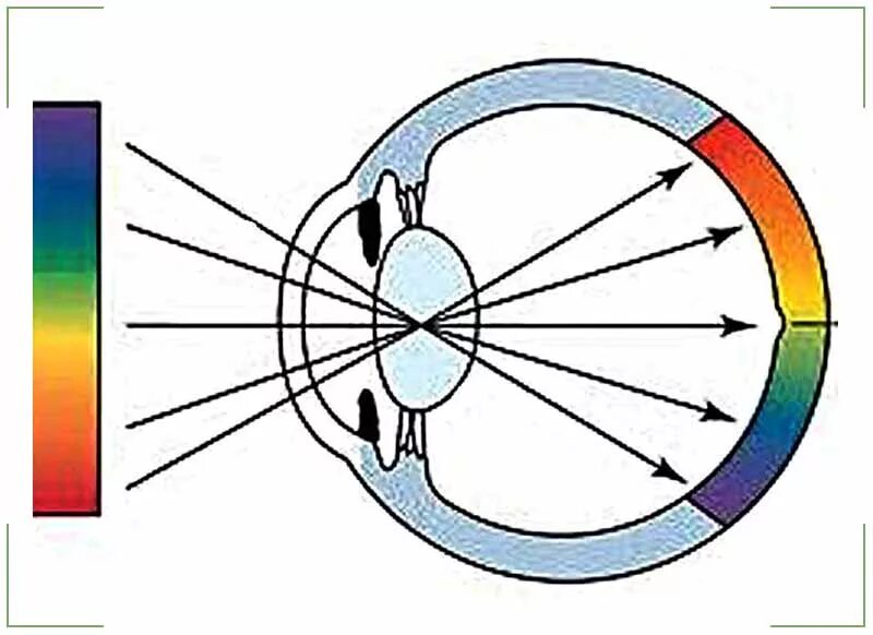Схема преломления лучей света хрусталиком глаза. Преломление лучей света в оптической системе глаза это. Схема преломления лучей в глазу. Преломление световых лучей глаза схема.