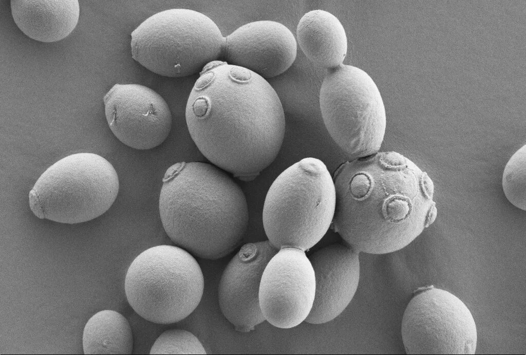 Дрожжи живые организмы. Клетку дрожжей Saccharomyces cerevisiae. Микроскопирование Saccharomyces cerevisiae. Пекарские дрожжи Saccharomyces cerevisiae. Saccharomyces turbidans колония.