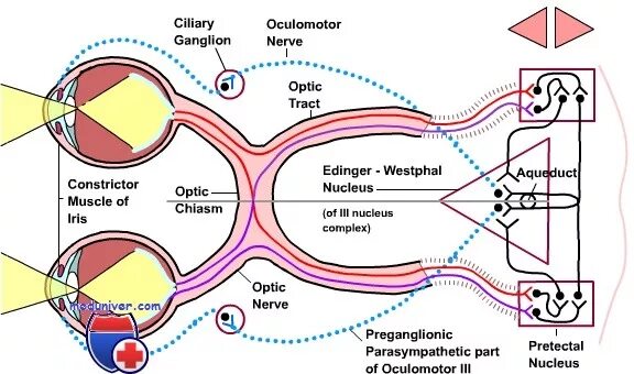 Рефлекторная дуга расширения зрачка. Схема рефлекторной дуги аккомодации. Схема рефлекторной дуги зрачкового рефлекса. Рефлекторная дуга зрачкового рефлекса.