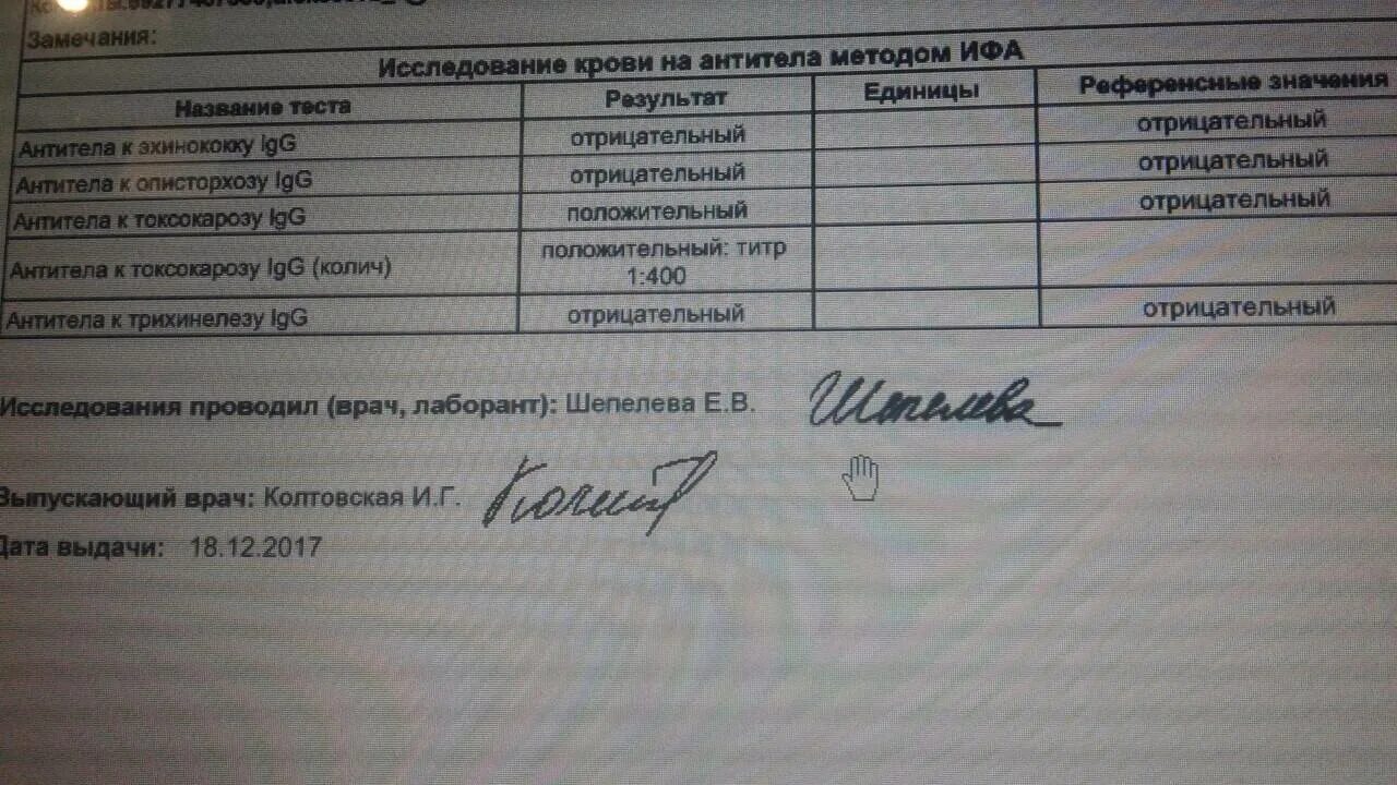 Результат анализа коклюш. Исследование крови на описторхоз. Анализ исследования на антитела крови.. Анализ крови на титр антител. Исследование сыворотки крови на антитела.