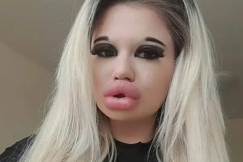 Big lips