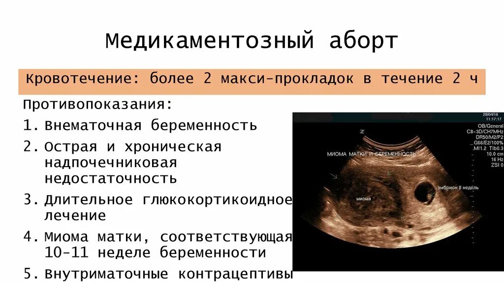 Обильные месячные после медикаментозного прерывания беременности. Медикаментозное прерывание беременности. Обильные месячные после медикаментозного прерывания беременности. Выделения после прерывания беременности. Медикаментозное прерывание беременности клинические рекомендации.