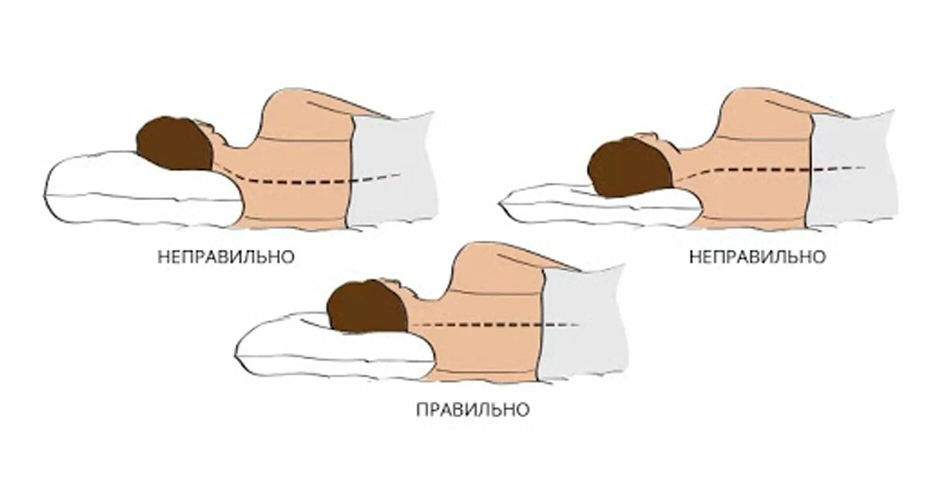 Можно ли подушку. Правильное положение головы во время сна. Правильная подушка. Правильное положение подушки для сна. Правильное положение головы на подушке.