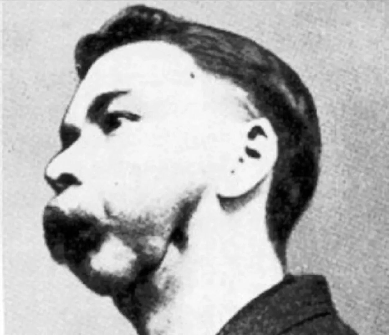 Человек пивший радий