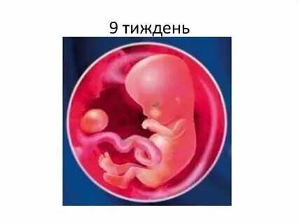 9 недель беременности перестала болеть