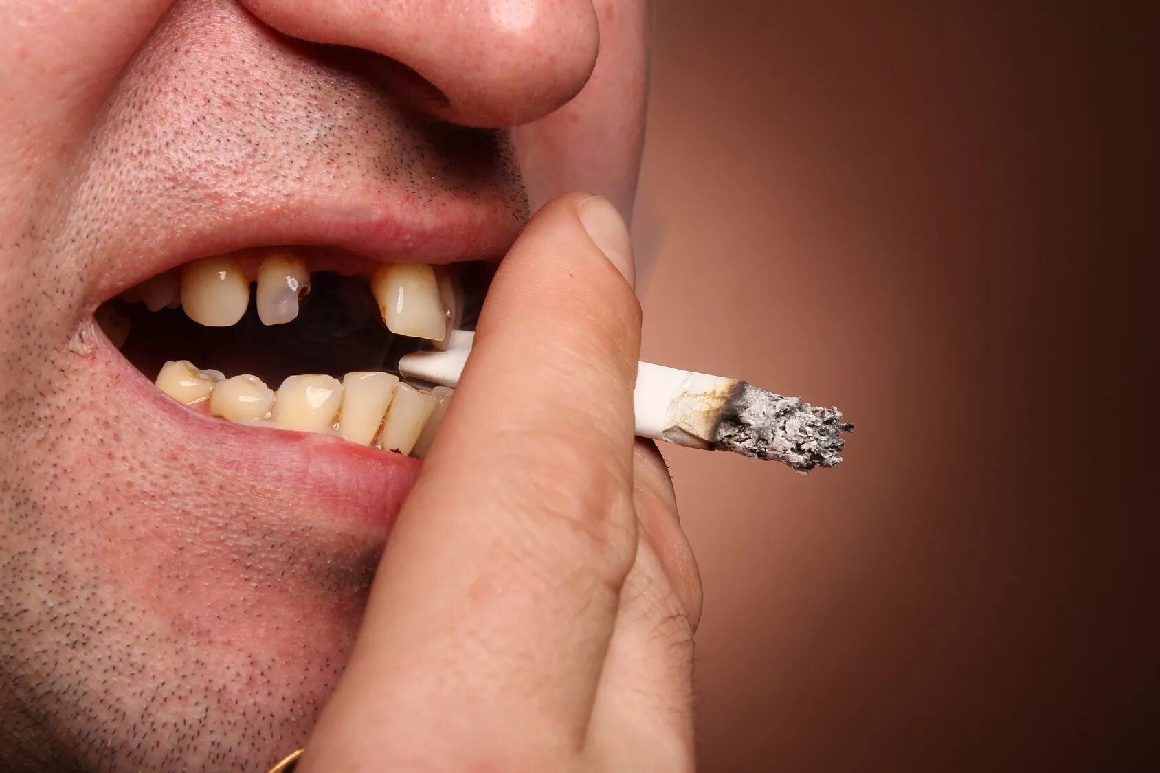Можно курить после стоматолога