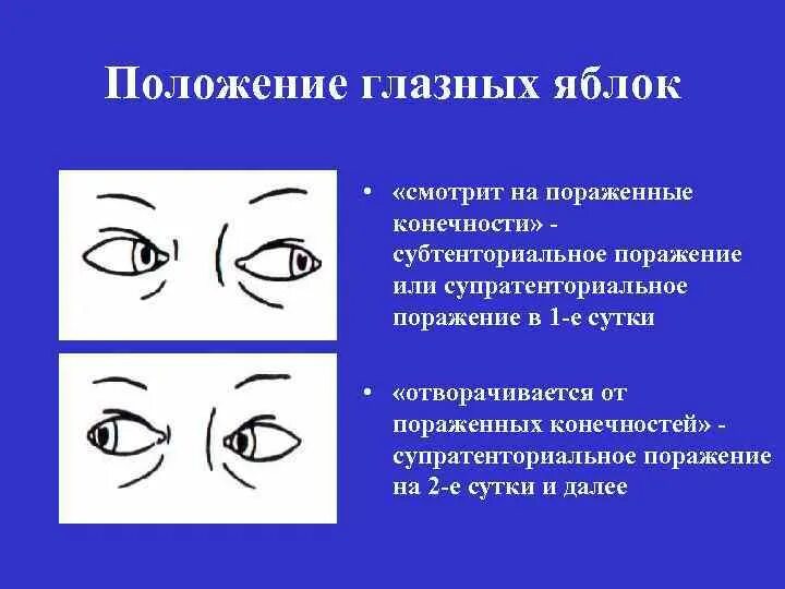 Положение глазных яблок в норме. Положение глазных яблок в глазницах криминалистика. положение глазного яблока в глазнице. положение глазной щели. форма глаз криминалистика.