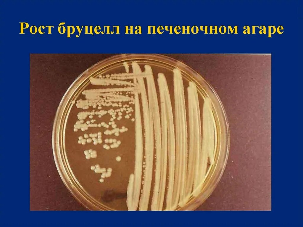 Бруцеллы на питательных средах. Рост бруцелл на питательных средах. Рост бруцелл на плотных питательных средах. Vibrio cholerae мясо пептонный агар\.