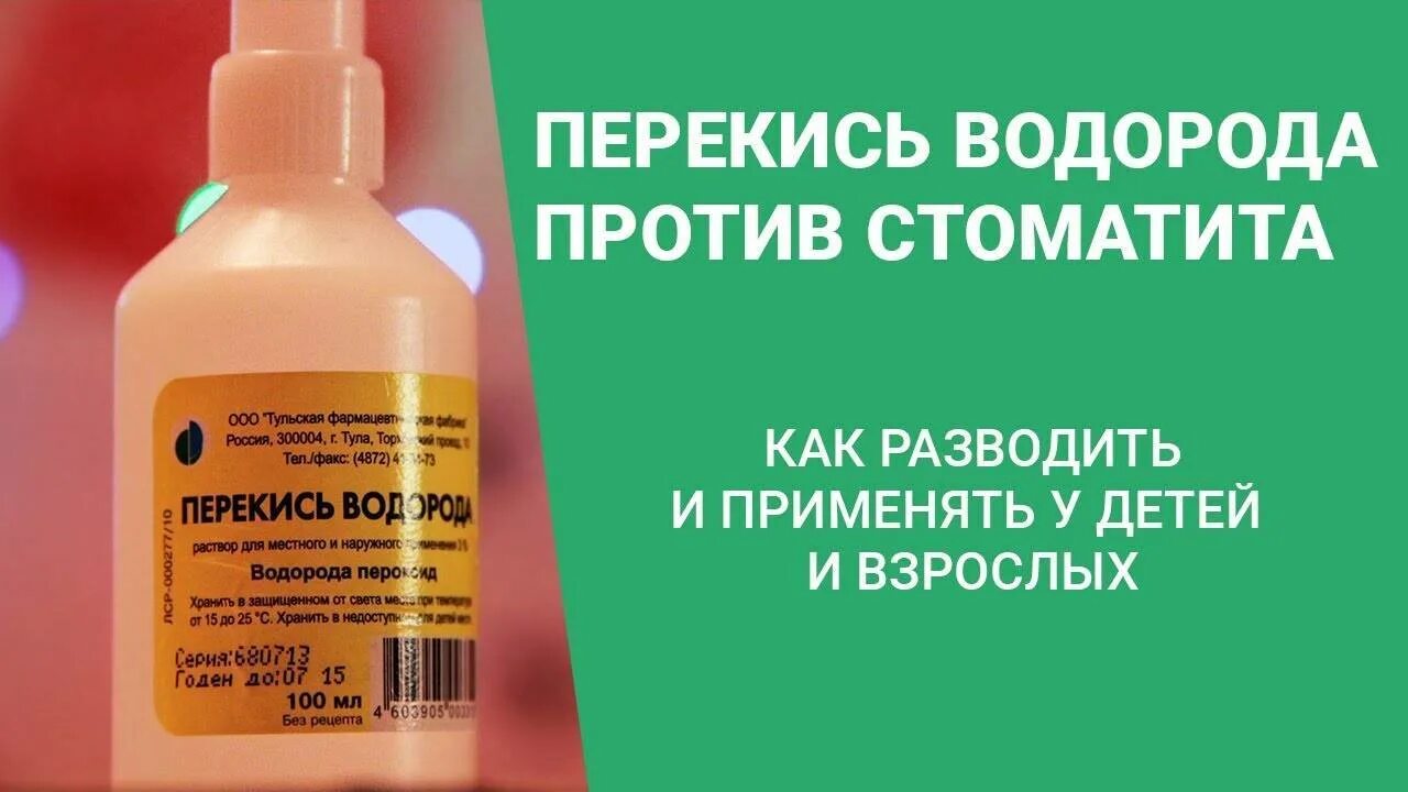 Стоматит чем полоскать рот в домашних условиях. Стоматит у детей препараты для лечения. Стоматит перекись водорода. Стоматит лечение у взрослых препараты. Лекарство при стоматите у взрослых.