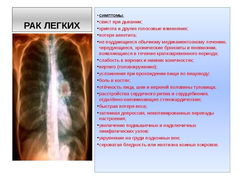 Боли при болезни легких. Онкология легких симптомы и признаки болезни. Онкология легкого симптомы. Легочная онкология симптомы. Раковые заболевания легких симптомы.