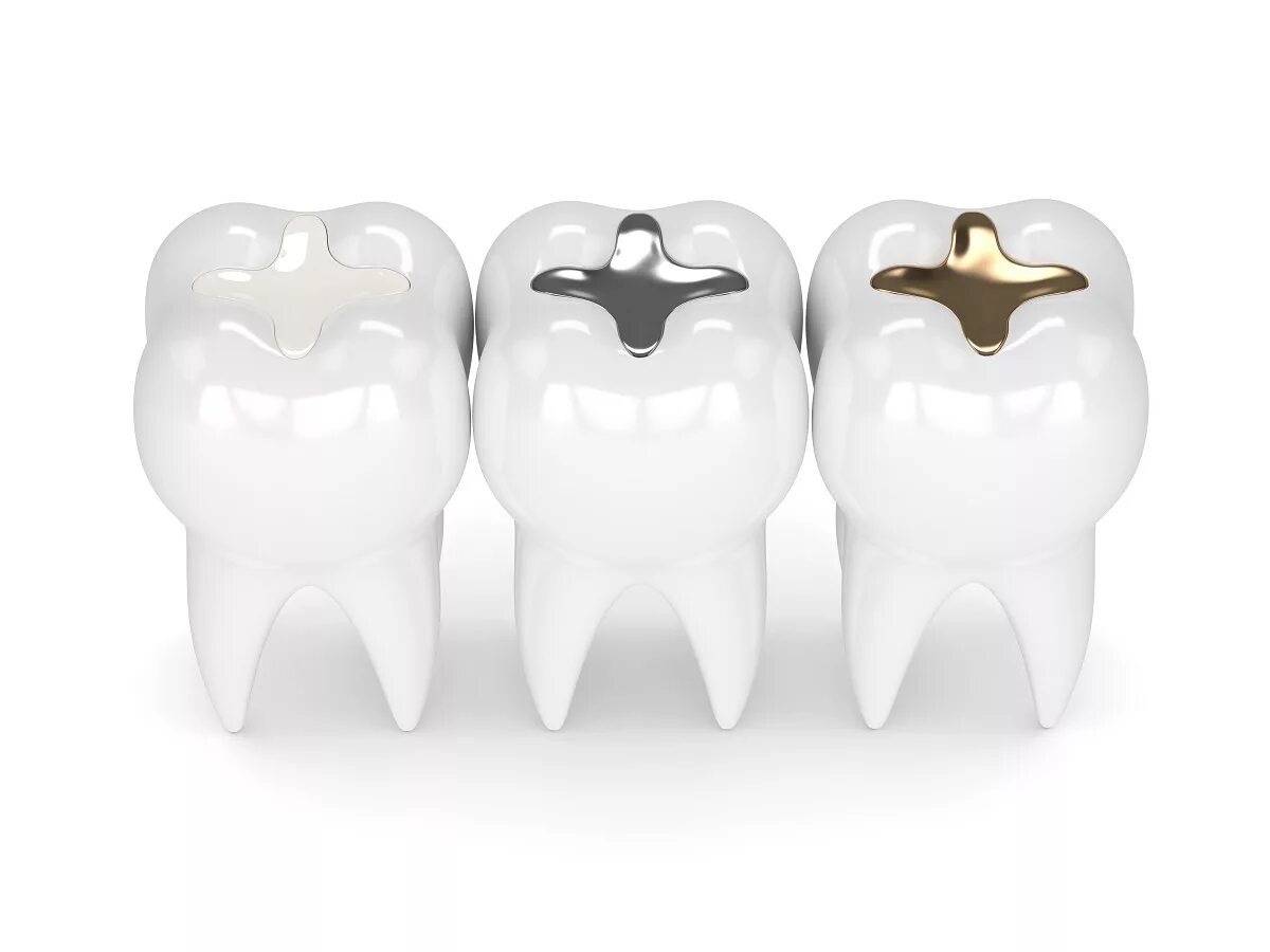 Tooth filling