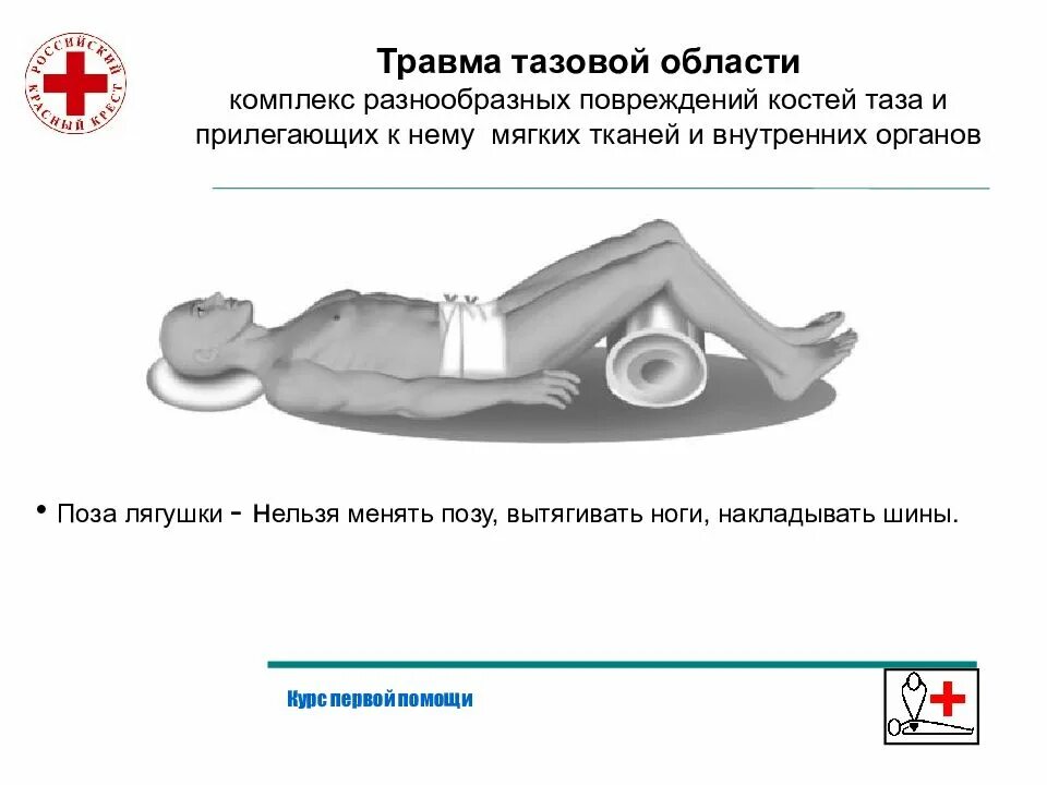 Как оказать первую помощь при переломе таза. Оказание первой помощи при травмах таза. пмп при переломе костей таза. травмы тазовой области. травма тазовой области первая помощь.