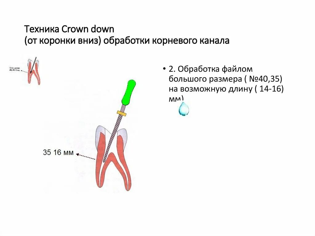 Определение корневых каналов. Инструментальная обработка корневых каналов. Стандартная техника обработки корневых каналов.