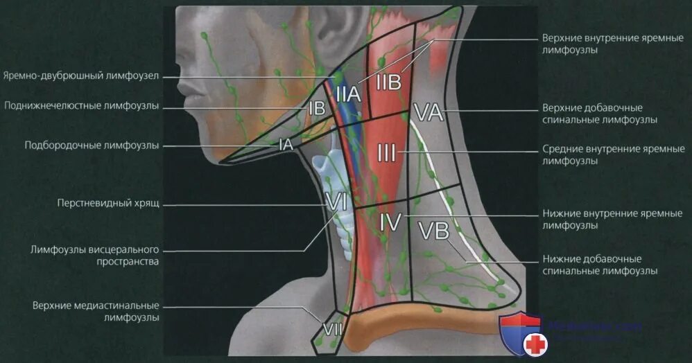 Лимфоузлы 3 месяца. Лимфатические узлы шеи кт. Лимфатические узлы шеи кт анатомия. Лимфатические узлы шеи 24 Radiology. Уровни лимфатических узлов шеи кт.