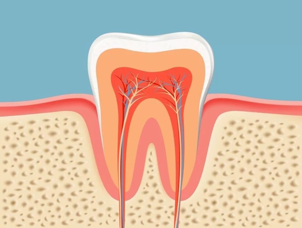 Расширение каналов зубов. Периодонтит эндодонтия.
