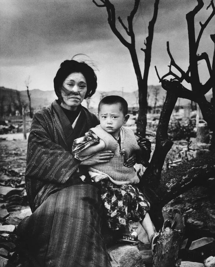 Нагасаки люди. Хиросима и нагасаки 1945 дети. Нагасаки люди. Бомбардировка хиросимы и нагасаки 1945. Нагасаки люди.