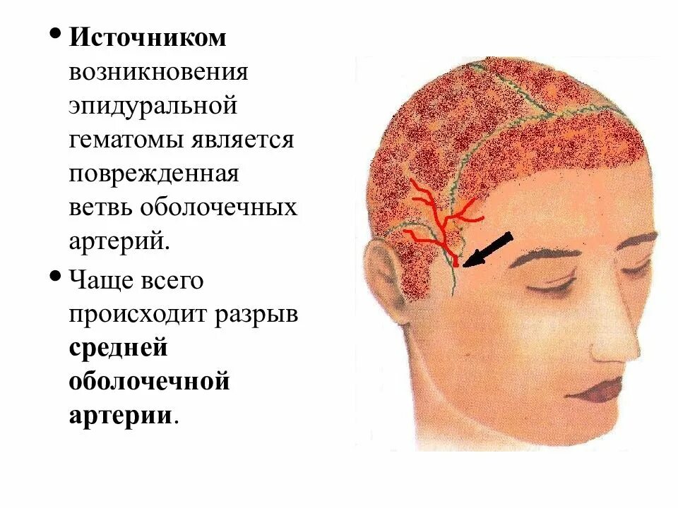 Закрытая черепно мозг травма. Черепно-мозговая травма. Презентация на тему черепно мозговые травмы. Черепно-мозговая травма головы. Закрытая черепно-мозговая травма.