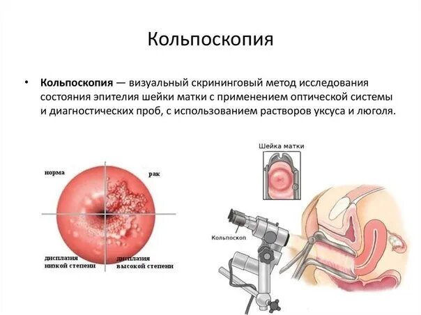 Можно Ли Заниматься Сексом Перед Гинекологом