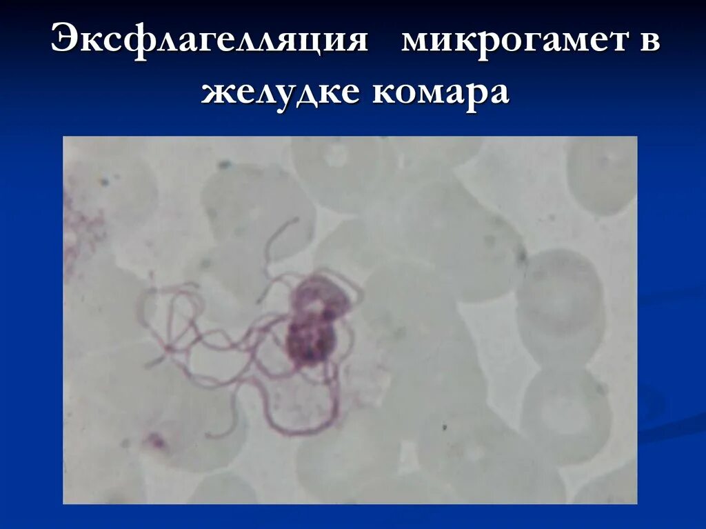 Микрогаметоцит это в паразитологии