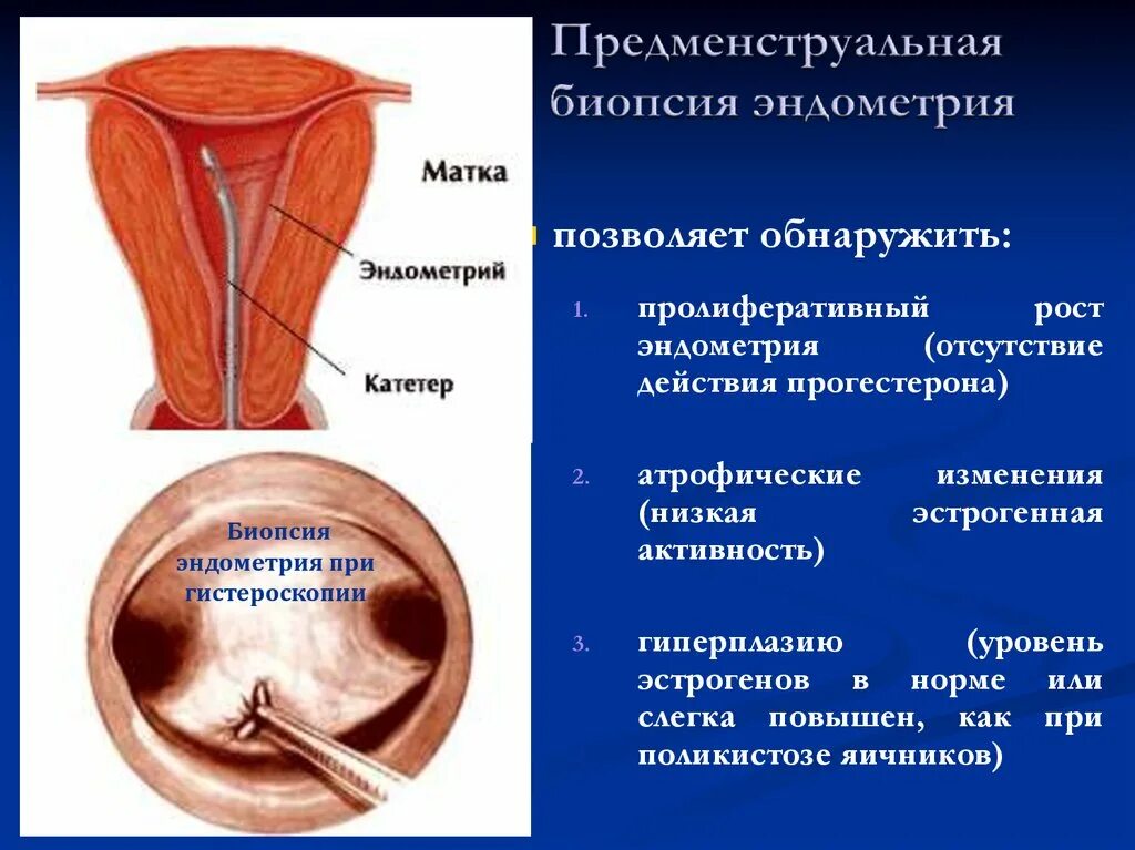 Увеличенная эндометрия матки