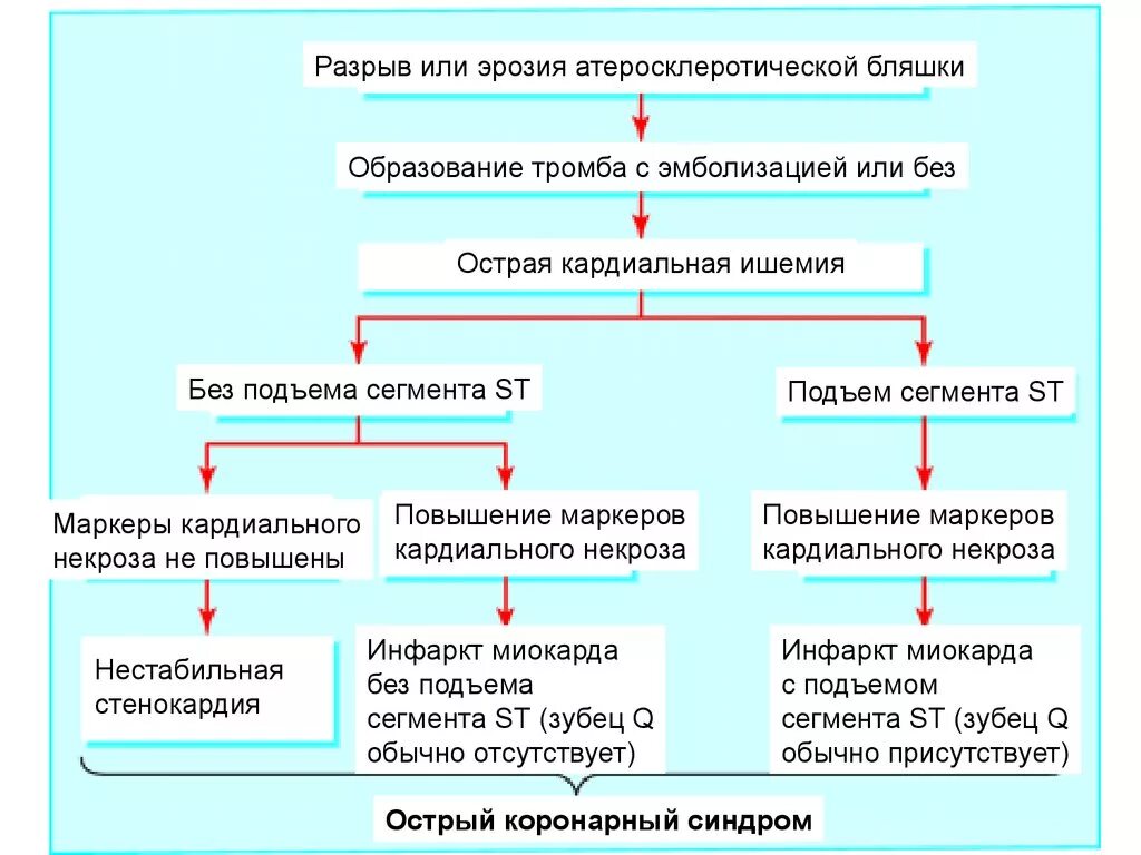 Варианты острого инфаркта миокарда