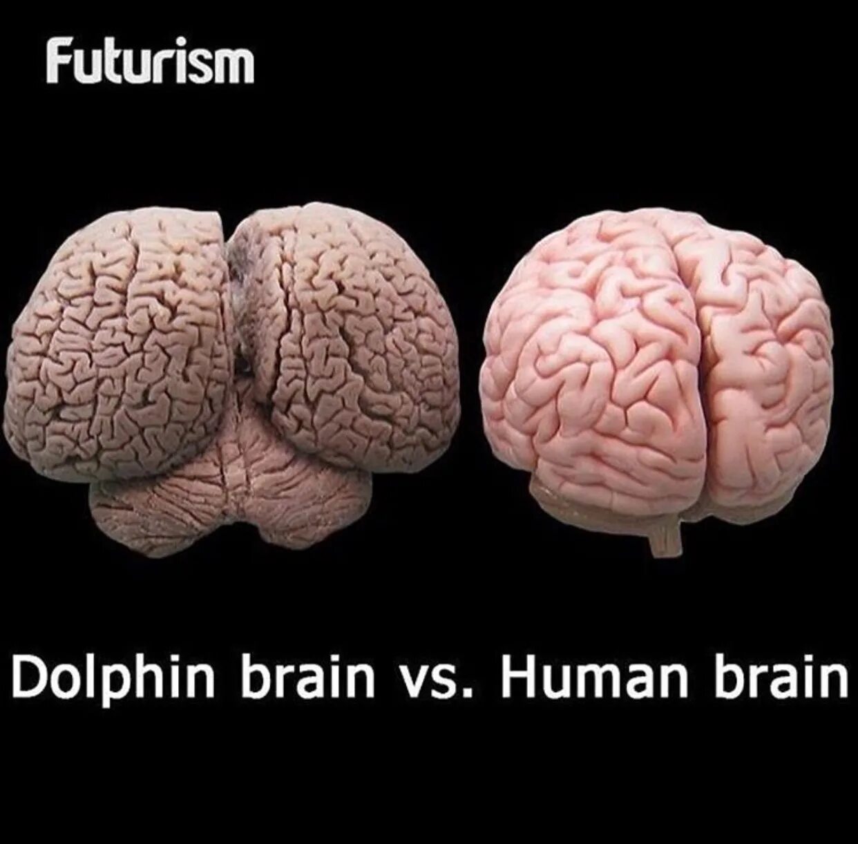 Мозг весит. Мозг дельфина и мозг человека. МОЗ Дельфин АИ человека. Размер мозга дельфина и человека.