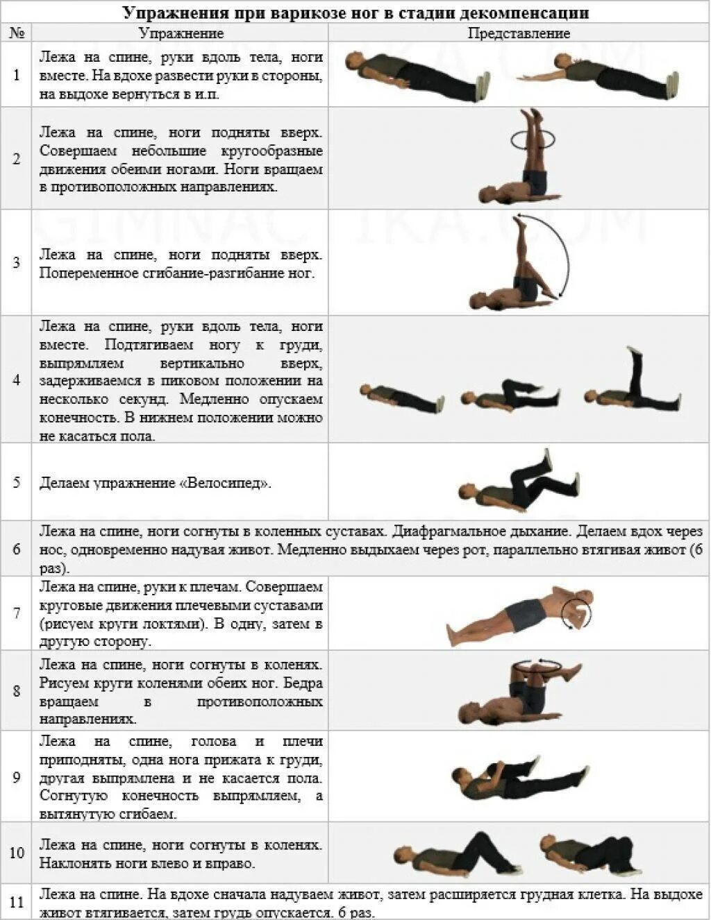 Варикозное расширение вен рекомендации. Гимнастика при варикозном расширении вен нижних конечностей. Лечебная физкультура при варикозном расширении вен. ЛФК при варикозе нижних конечностей комплекс упражнений. Гимнастика при облитерирующем атеросклерозе нижних конечностей.