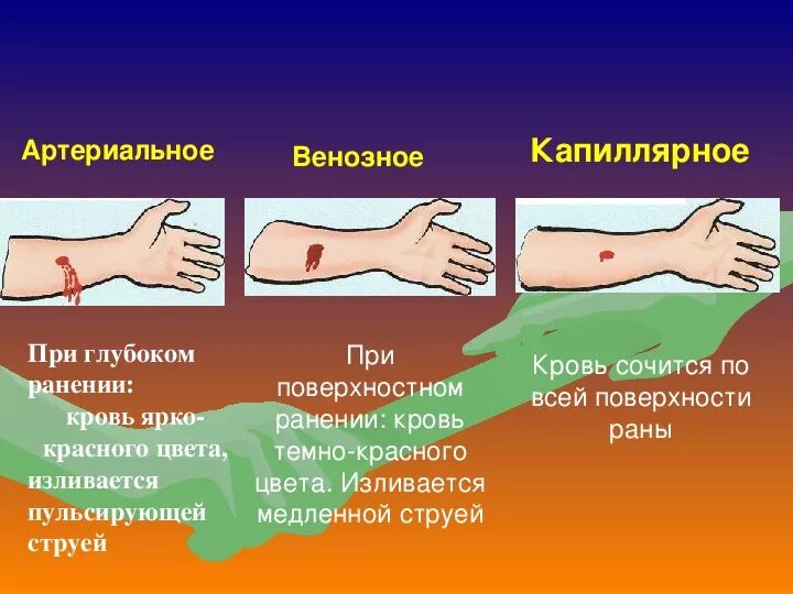 Особенность артериальной крови. Артериальное венозное капиллярное. Капиллярное и венозное кровотечение. Венозное и артериальное кровотечение цвет. Давление венозное артериальное капиллярное.