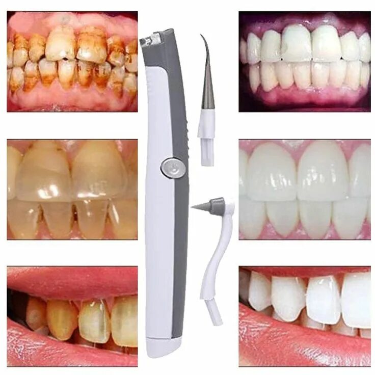 Blanqueador de dientes,higiene Oral de limpieza,limpieza Dental, eBay