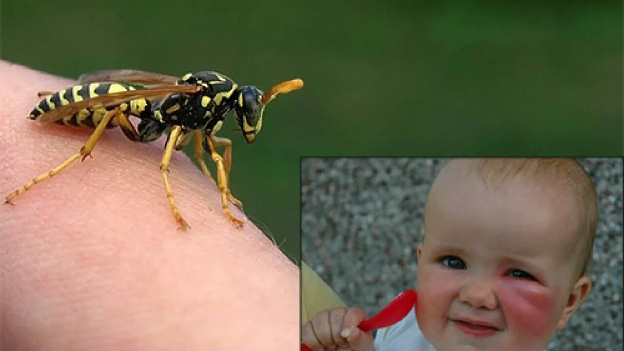 Шмель пчела Оса Шершень укусы. Насекомые для детей. Сколько укусов пчел
