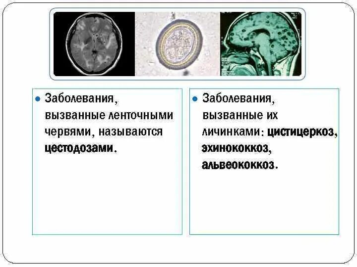 Заболевания вызываемые ленточными червями