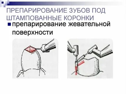 Препарирование это
